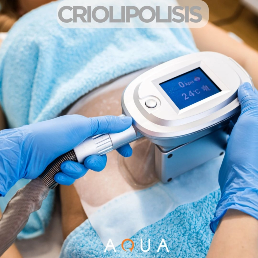 Criolipolisis